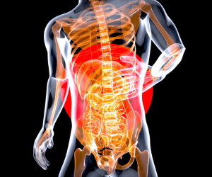 Your Stomach Contains Acid Strong Enough to Dissolve Metal